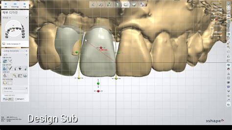 Image result for 3Shape Design Software