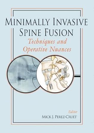 Buy Minimally Invasive Spine Fusion: Techniques and Operative Nuances ...