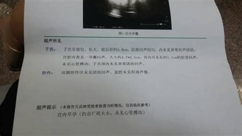 出现胎停育后该如何处理?多久才能再次备孕？ - 知乎