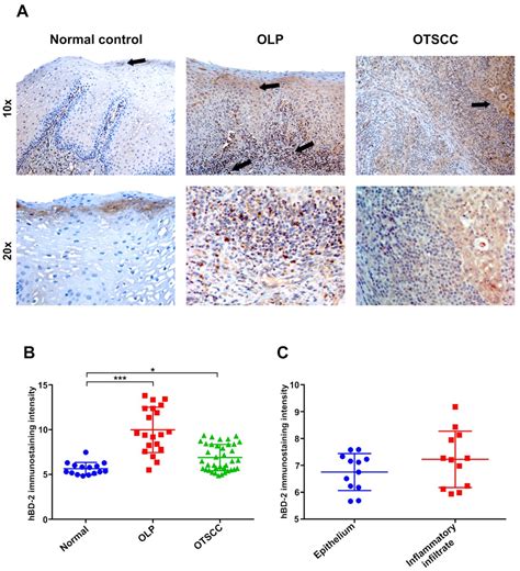 Human β-Defensin 2 Expression in Oral Epithelium: Potential Therapeutic ...