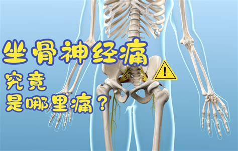 【疾病的奥秘】：3D还原--坐骨神经痛_哔哩哔哩_bilibili