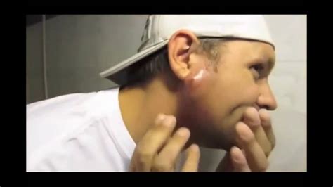 Exploding Pimples 2018 的图像结果