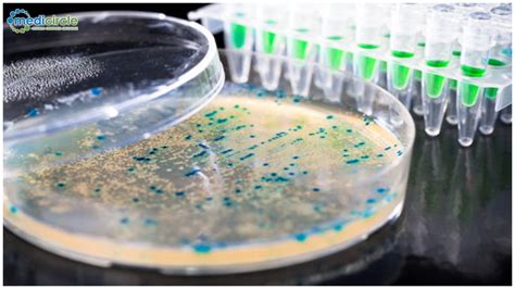 Using a machine-learning algorithm, researchers have identified a ...