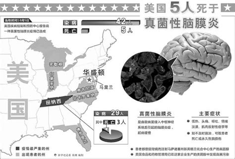 美国多地暴发真菌性脑膜炎(图)|美国|真菌性脑膜炎_新浪新闻
