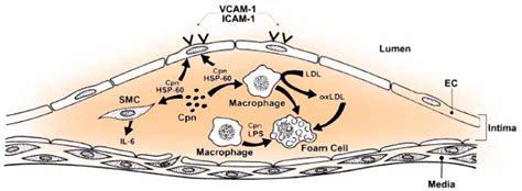 Diabetes India - Pathological-microbiological evidence is ...