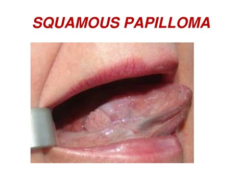 PPT - ORAL CAVITY PowerPoint Presentation, free download - ID:255788