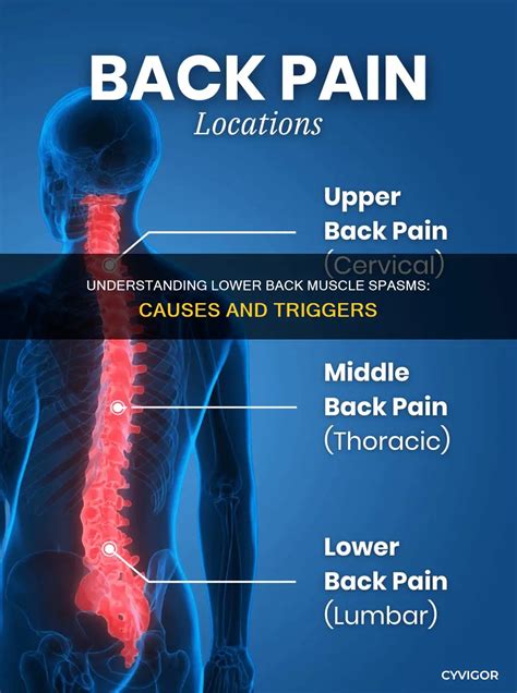 Lower Back Muscle Spasm 的图像结果