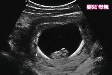 懷孕初期胎兒腦部、心臟發育關鍵階段，如何判斷是正常或異常？ | 嬰兒與母親