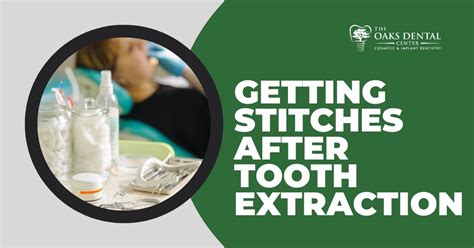 Image result for Stitches After Tooth Extraction