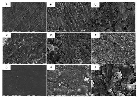 Effect of Surface Treatments and Thermal Aging on Bond Strength Between ...