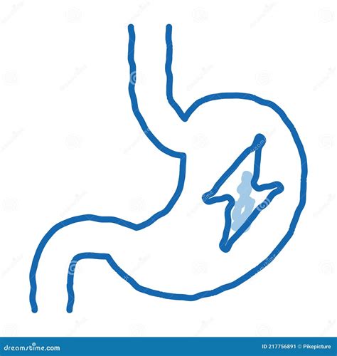 Malestar Estomacal Síntoma De Embarazo Doodle Icono Mano Dibujado Ilustración Ilustración del ...