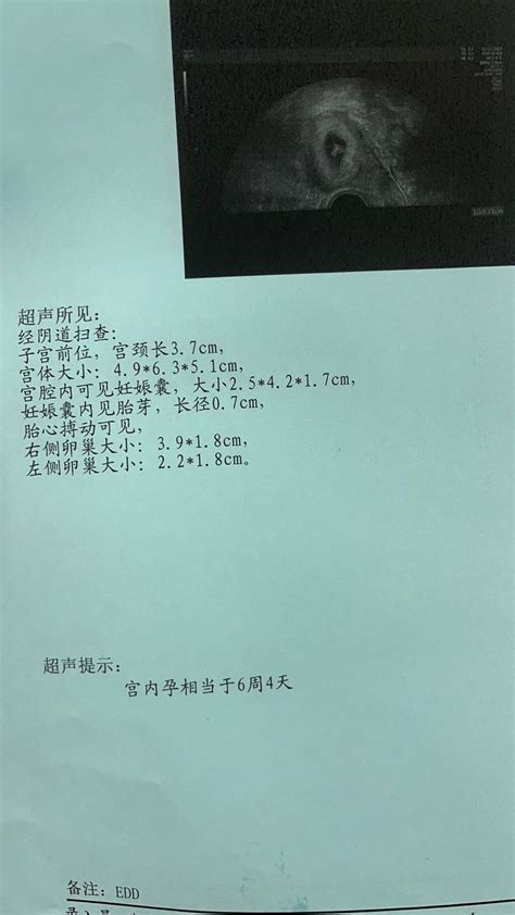 试管婴儿_国内专业第三代试管婴儿生殖网站 - 好孕无忧