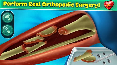 Image result for Surgery Computer Games