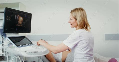 Ultrasound 的图像结果