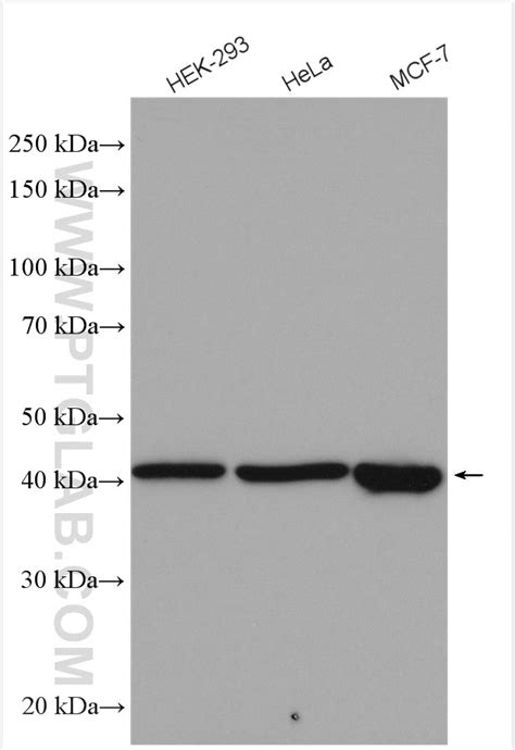 PRMT6 antibody (15395-1-AP) | Proteintech