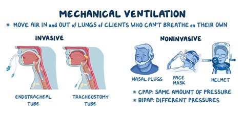 Video: Respiratory: Mechanical ventilation | Osmosis