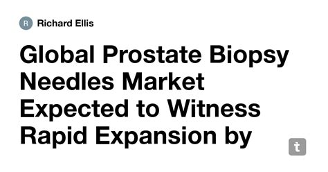 Global Prostate Biopsy Needles Market Expected to Witness Rapid ...