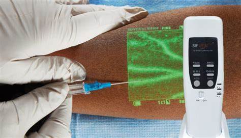 Wireless Ultrasound Scanners | Vein Finder | Healthcare Robot - SIFSOF