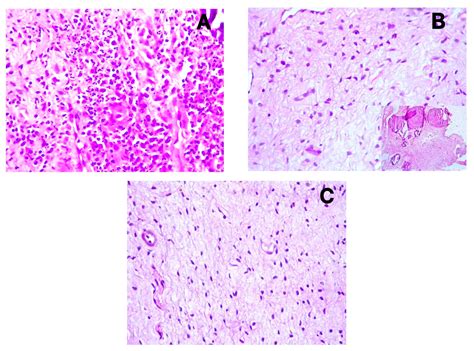 Differential Regulation of Angiogenesis, Lymphangiogenesis, and Neural ...