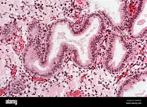 Image result for Endometrium