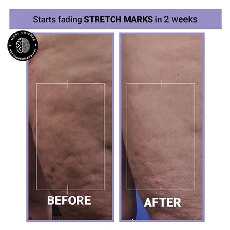 Best Skincare Brand in India | Psychodermatological Skincare