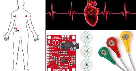 Build an ECG with Arduino