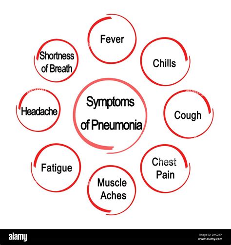 Chest pneumonia Cut Out Stock Images & Pictures - Alamy