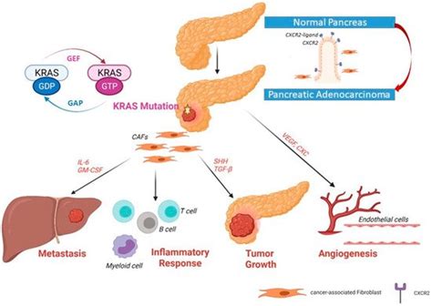 KRAS in Pancreatic Adenocarcinoma Microenvironment | Encyclopedia MDPI
