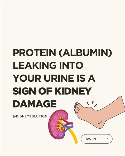 KIDNEYSOLUTION | KIDNEY DISEASE | Albuminuria means there’s protein (albumin) leaking into your ...