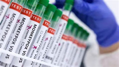 Monkeypox threat: DPH’s fresh guidelines to airport officials