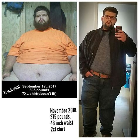 M/29/5'11" [605 pounds > 375 pounds = 230 pounds lost] (14 months ...