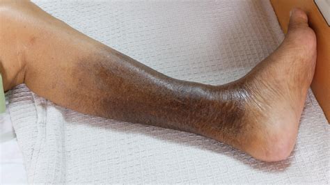Shiny Skin On Legs