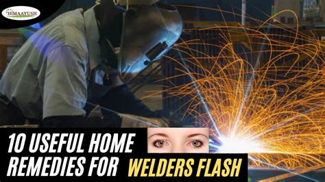 Image result for Weld Flash