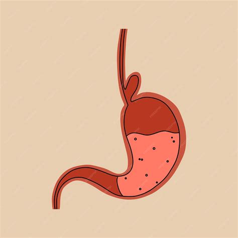 Premium Vector | Hernia of the esophagus stomach problem vector illustration in flat style