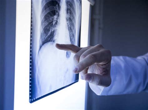 Cancer Day: Have you been experiencing pain or swelling in bones for ...