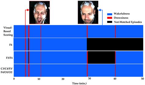 Association of Visual-Based Signals with Electroencephalography ...