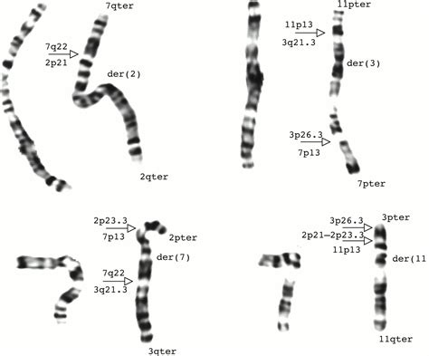 Coffin Lowry Syndrome Punnett Square