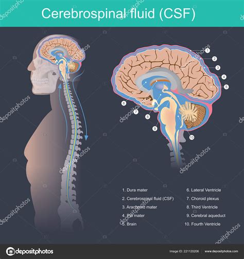 Cerebrospinal Fluid Color