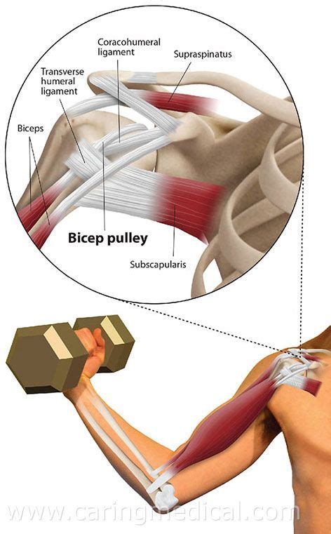 Image result for Shoulder Labral Tear Surgery