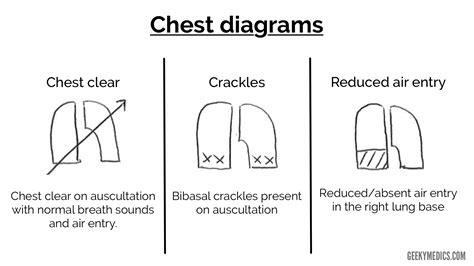 Types Of Chest Examination at Gail Carroll blog