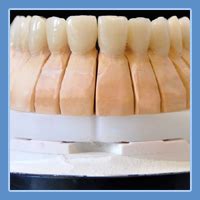 Metal Free Dental Bridge Making Lab In Delhi | Metal Restorations ...