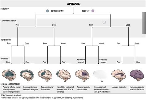 Image result for Aphasia Classification Chart