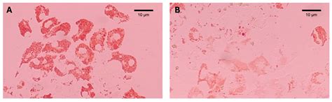 Effects of Temperature and Salinity on the LMS (Lysosomal Membrane ...