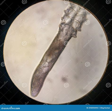 Demodex Folliculorum - Parasitic Mite on the Eyelashes of a Human Eye Stock Photo - Image of ...