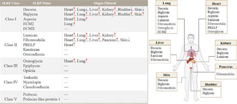 Image result for Slrp Connection