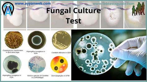 Cryptococcus Neoformans Culture