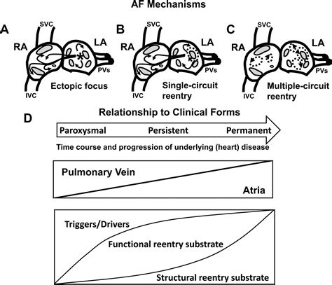 Atrial Fibrillation Pathophysiology | Circulation