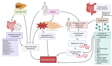 Are Hemorrhoids Genetic