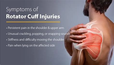 Image result for Rotator Cuff Repair Photo