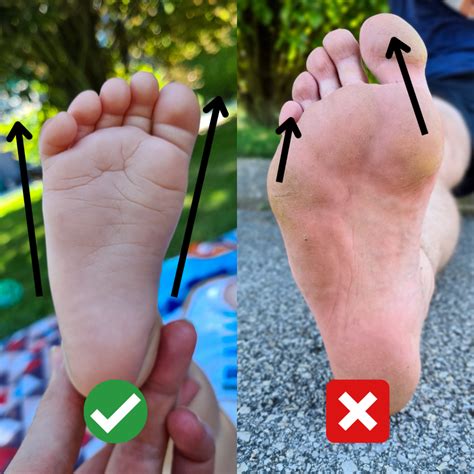 What is my Foot Type? - Barefoot Universe